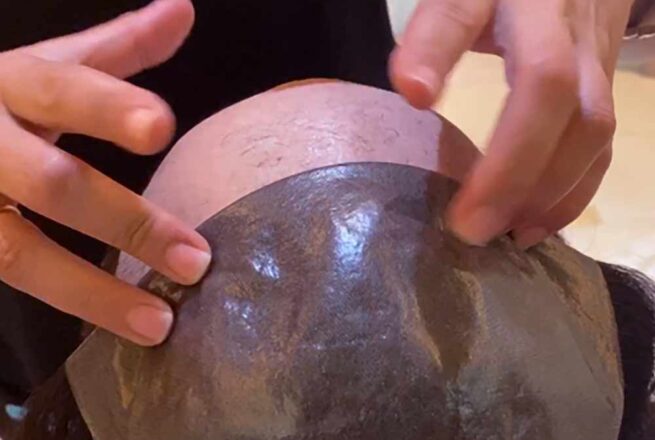 peruces-prosthetiki-malliwn-eshop-wigipedia-ypiresies-efarmogi-andriko-prostheto-carousel-001