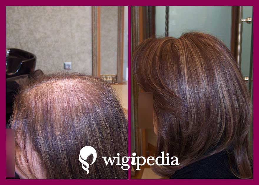 wigs-hair-prosthesis-eshop-wigipedia-results-women-before-after-027061PG-001